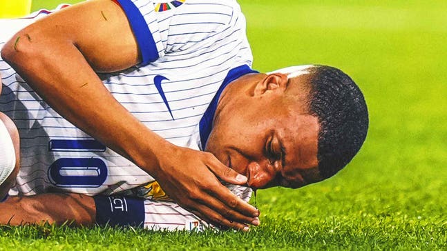 Kylian Mbappé to miss Netherlands match as he progresses from broken nose